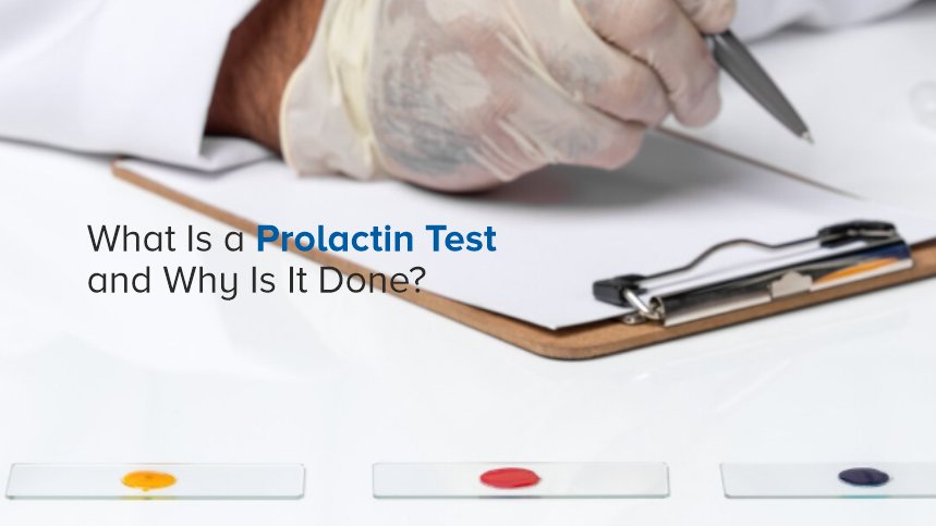 What Is a Prolactin Test and Why Is It Done